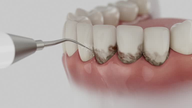 Trusted Teeth Cleaning And Checkup service in Hopkins, MN - Dentist Open Now
